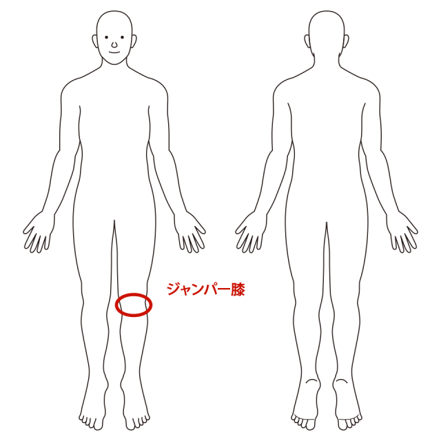 左膝のお皿の下
